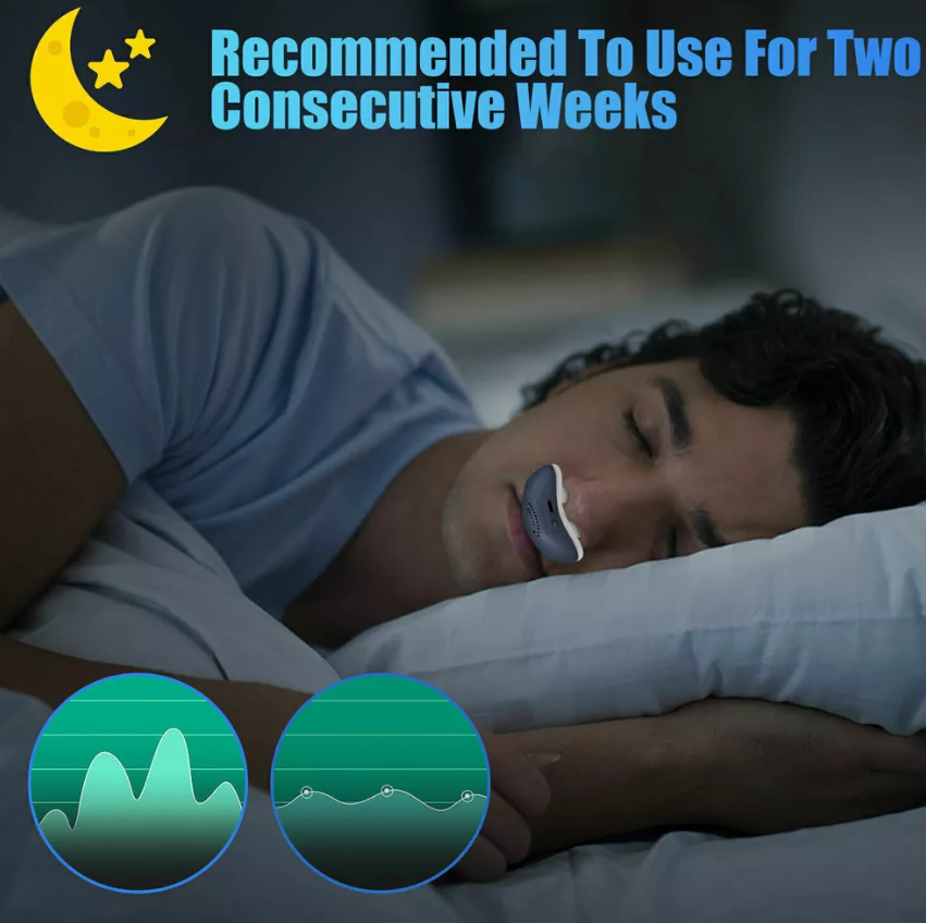 "Mini appareil CPAP anti-ronflement compact, sans masque, avec embouts souples en silicone pour un sommeil paisible."