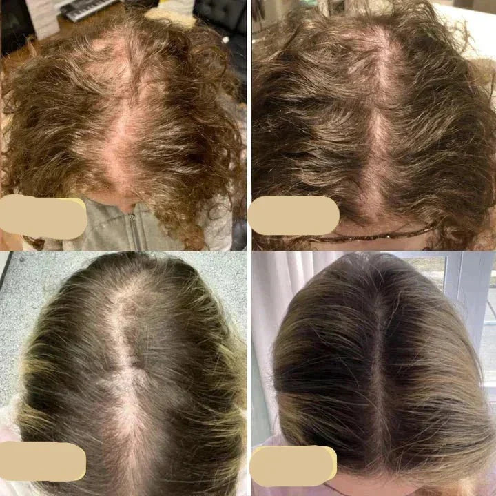 "Flacon d'huile capillaire végane, booste la croissance des cheveux grâce à l'huile d'argan et au romarin."